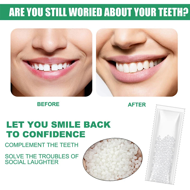 Resin Temporary Tooth Repair Glue – Moldable Dental Filler - EverGrowMarkeplace