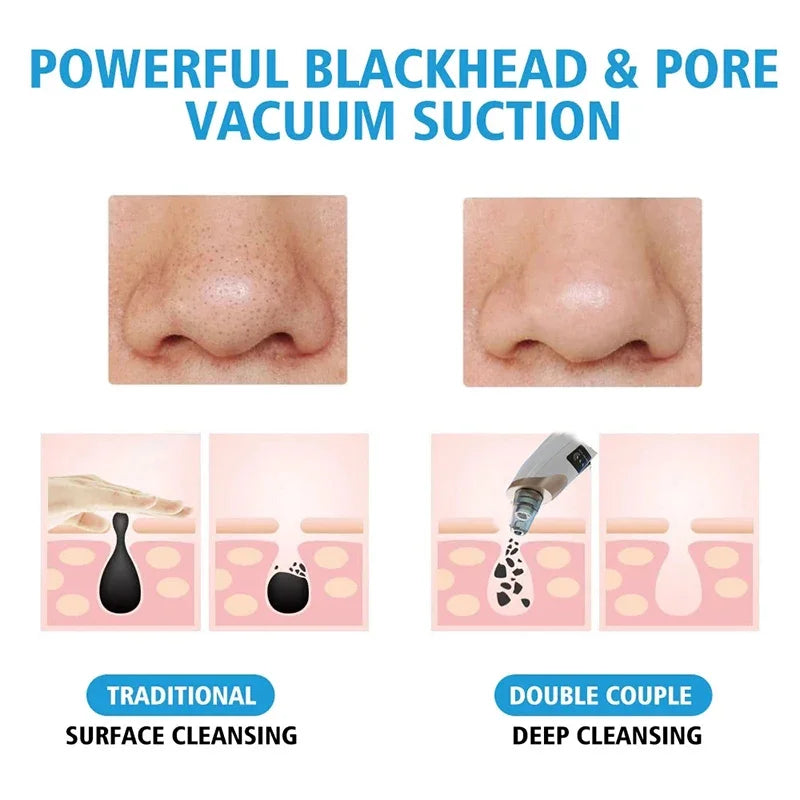 Electric Blackhead Vacuum Pore Cleaner with LED Display