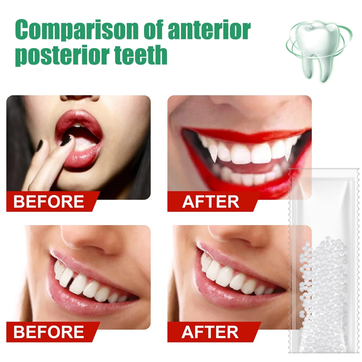 Resin Temporary Tooth Repair Glue – Moldable Dental Filler - EverGrowMarkeplace