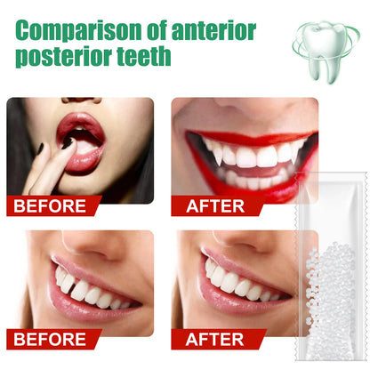 Resin Temporary Tooth Repair Glue – Moldable Dental Filler - EverGrowMarkeplace