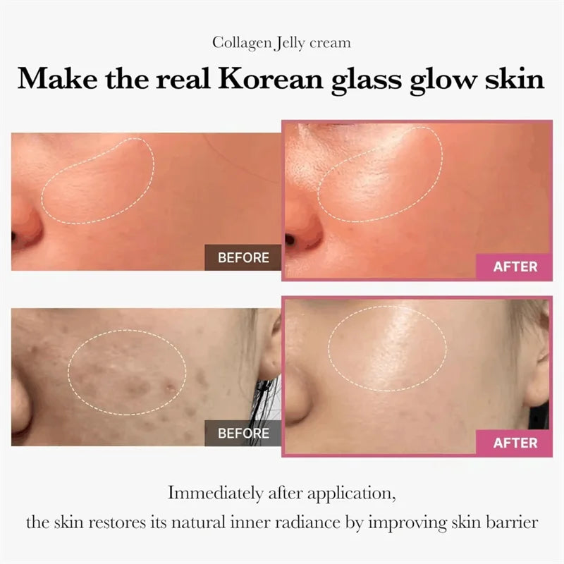Collagen Jelly Face Cream With Niacinamide – Pore Care - EverGrowMarkeplace