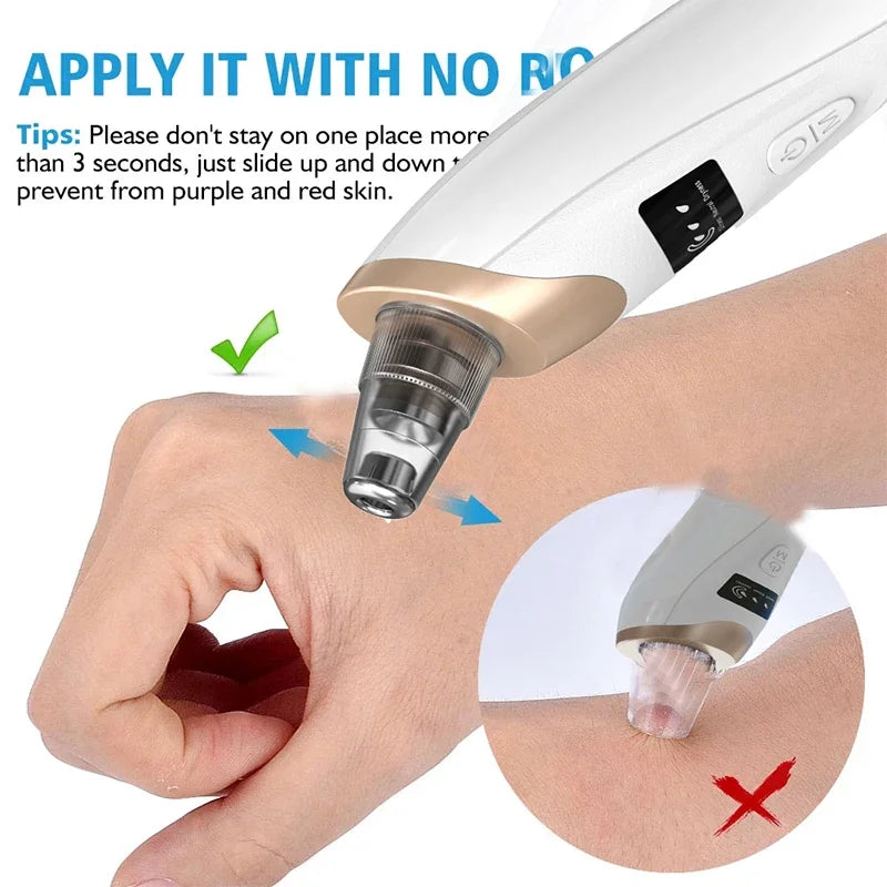 Electric Blackhead Vacuum Pore Cleaner with LED Display
