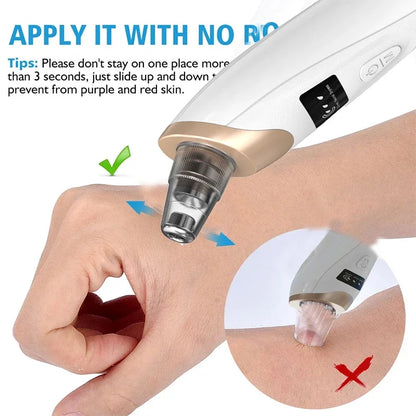 Electric Blackhead Vacuum Pore Cleaner with LED Display