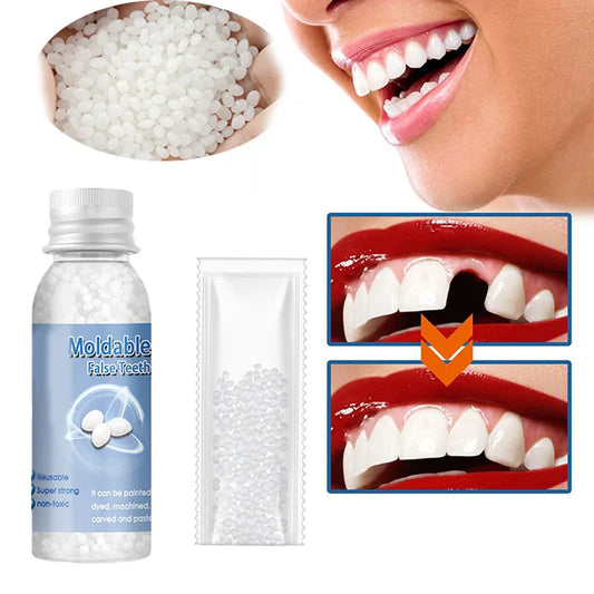 Resin Temporary Tooth Repair Glue – Moldable Dental Filler - EverGrowMarkeplace