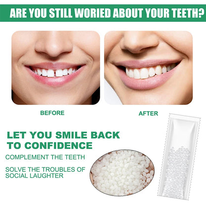 Resin Temporary Tooth Repair Glue – Moldable Dental Filler - EverGrowMarkeplace